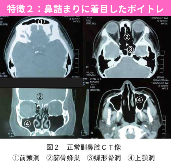 KISS MUSIC(KISS MUSIC)の特徴２ 鼻詰まりに着目したボイトレ頭式呼吸